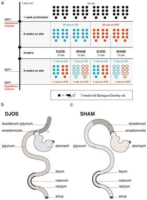 High Fat, High Sugar Diet and DJOS Bariatric Surgery Influence Plasma ...