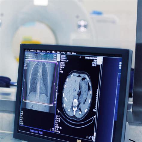 Image result for Soft Tissue Sarcoma