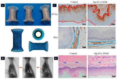 Research on the Current Application Status of Magnesium Metal Stents in ...