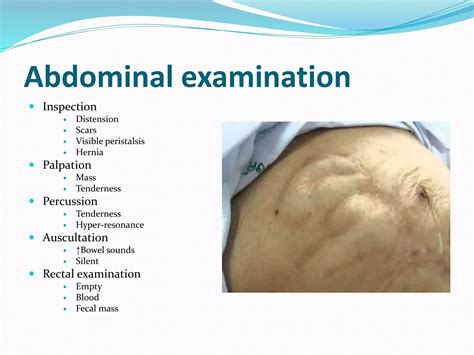 01.abdominal swelling 1 | PPTX