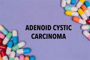 Adenoid Cystic Carcinoma: Symptoms, Diagnosis and Treatments