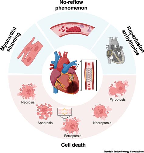 Regulated cell death in myocardial ischemia–reperfusion injury: Trends in Endocrinology & Metabolism