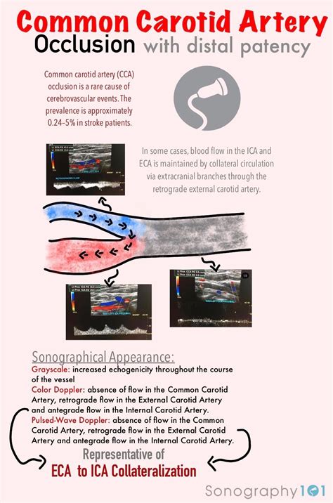 occluded patient side - The Utility of Energy