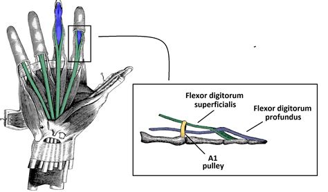 Hand Anatomy Flexor Tendons