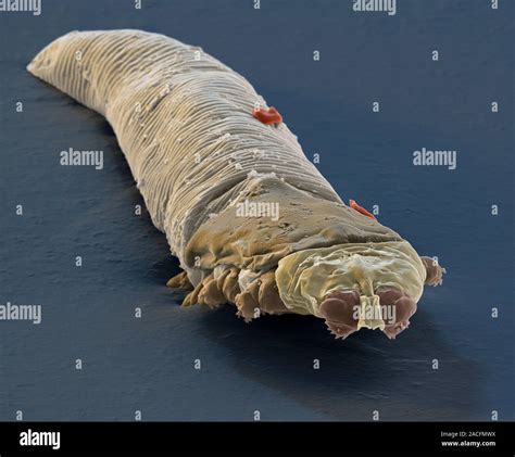 Eyelash mite, coloured scanning electron micrograph (SEM). Eyelash ...