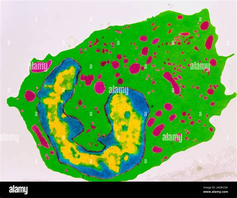 Image result for Monocyte Electron Microscope