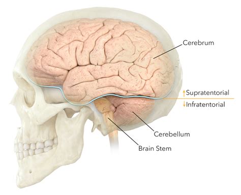 Brain Tumors Types | Expert Surgeon | Aaron Cohen-Gadol, MD