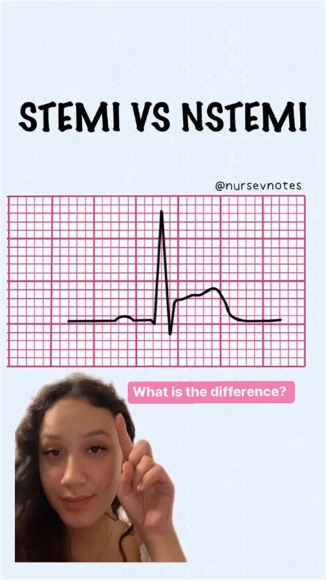 Stemi vs nstemi nursing students you need to know this ekg ...