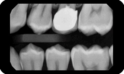 DTX Studio Clinic Imaging Software | DEXIS