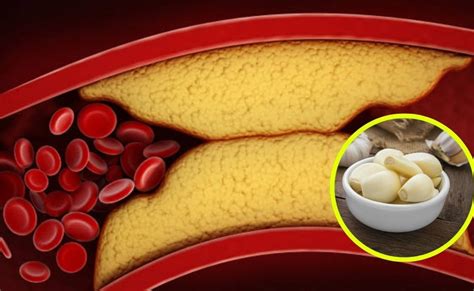 Cholesterol के मरीज रोज खा लें रसोई में रखी ये सफेद चीज, डॉक्टर ने ...