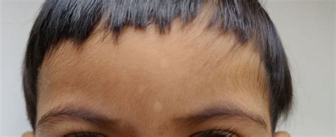 What are these spots? | BabyCenter