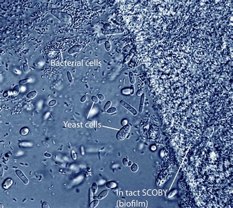 Bacteria Reproducing Under a Microscope 的图像结果