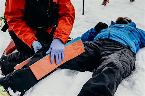 Image result for Sam Splint Vs Other Splints