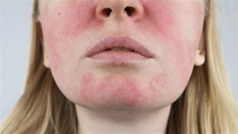 Understanding Skin Sensitivity to Touch: Causes, Symptoms, and Treatme – QRxLabs