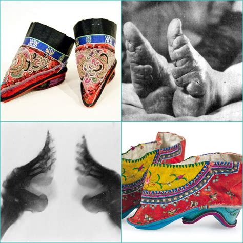 Funky Doodle Donkey: Foot binding ~ Lotus shoes