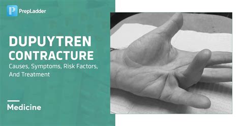 Dupuytren Contracture: Causes, Symptoms, Risk Factors & More