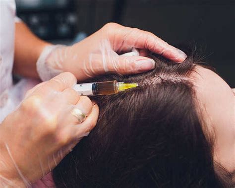 Plasma Injections for Hair Loss: What you need to know | Femina.in