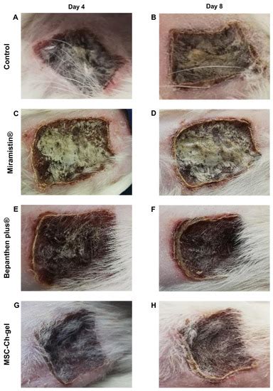 Antimicrobial and Regenerative Effects of Placental Multipotent ...