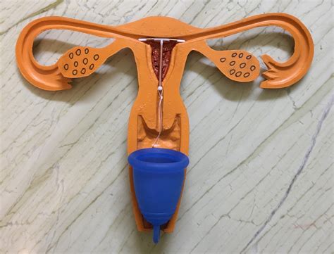 Using A Menstrual Cup And IUD: What You Need To Know
