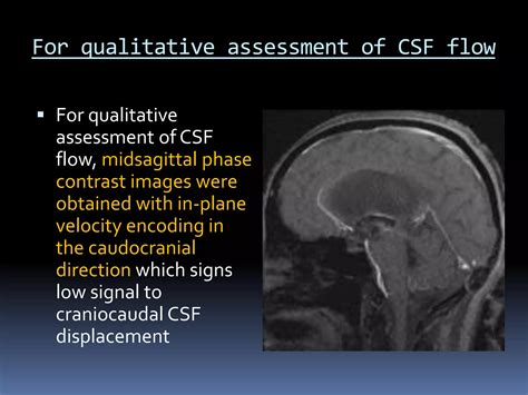Image result for CSF Flow Test