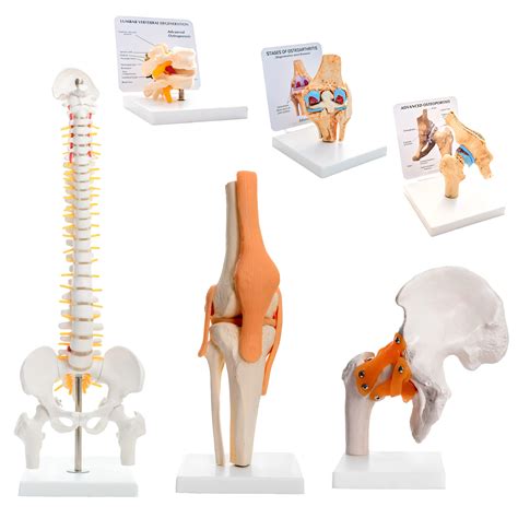 Kay Kay Industries (Set of 6)- 45 cms Spine Model, Life Size Hip Joint ...