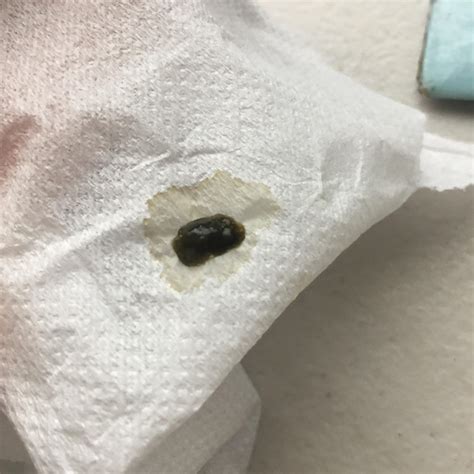 My late hedgehog's X-Ray, can anyone tell if there's something bad with ...