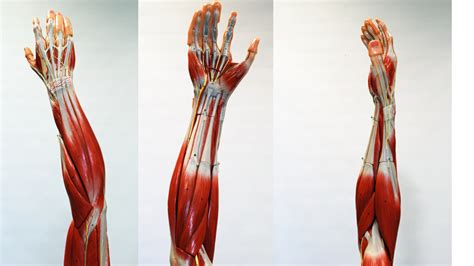 Image result for Contralateral Forearm