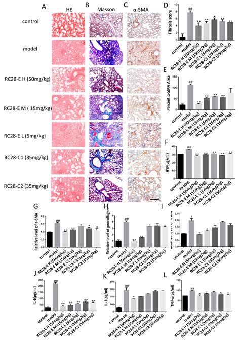 Pharmacology Study of the Multiple Angiogenesis Inhibitor RC28-E on ...