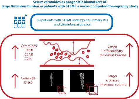 Serum Ceramides as Prognostic Biomarkers of Large Thrombus Burden in ...