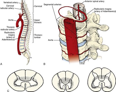 Orthopedic Surgery Anesthesia Management 的图像结果