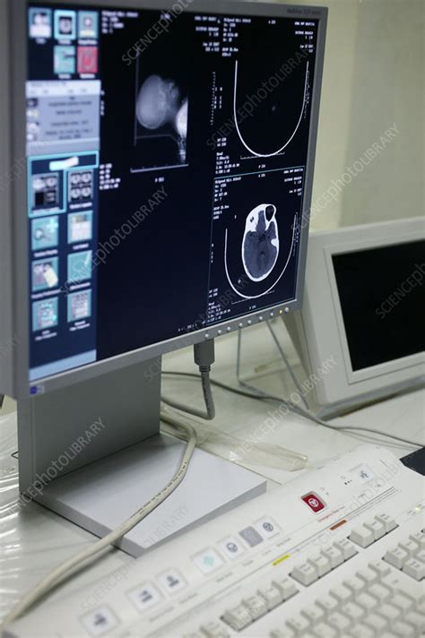 Image result for CT Scanner Control Panel