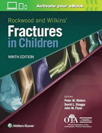Buy Rockwood and Wilkins Fractures in Children Book Online at Low ...