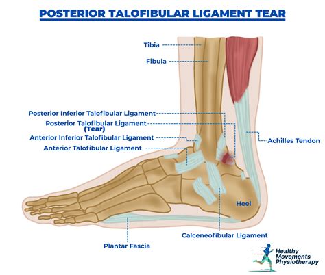 Foot & Ankle Injuries - Healthy Movements Physiotherapy