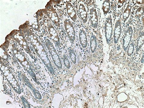 NHE8 antibody (18318-1-AP) | Proteintech