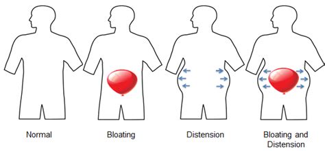 What Actually Happens in Your Body When You Feel Bloated? The Biology ...