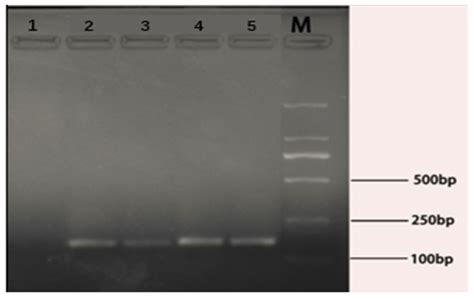 Contrast of Real-Time Fluorescent PCR Methods for Detection of ...