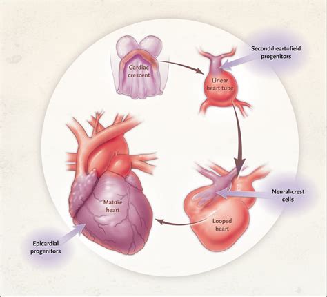 Image result for Heart Abnormal Development