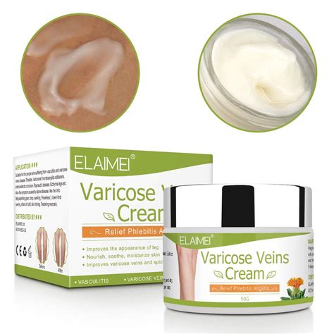 Buy Varicose Veins Cream for Legs Eliminate Varicose Veins and Spider ...