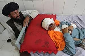 A Young Child is Victim of an IED Attack in Afghanistan Poster Print by ...