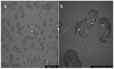 Polymeric Nanoparticles and Chitosan Gel Loading Ketorolac Tromethamine ...