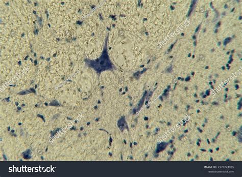 Neurons Processes Under Microscope Nervous Tissue Stock Photo 2170224985 | Shutterstock