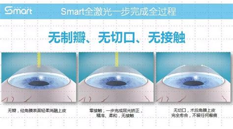 Smart 全车贝壳口红改色贴膜 - 汽车玻璃膜 - 上海缔奇堂汽车服务有限公司
