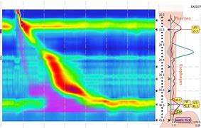 Image result for manometry
