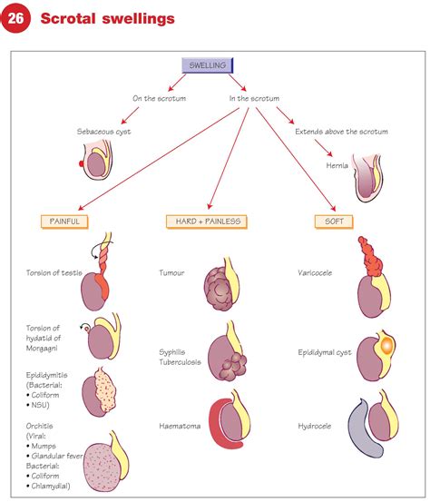 Scrotal Swellings - Causes, Diagnosis & Treatment