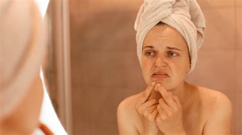 स्क्लेरोडर्मा (ऑटोइम्यून बीमारी) के लक्षण और कारण | What Is Scleroderma ...