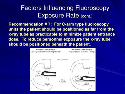 Image result for Fluoroscopy Magnification