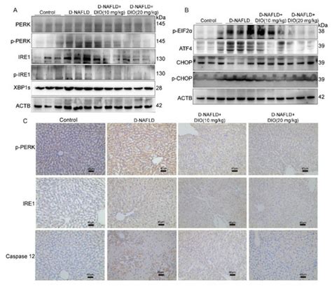 Diosgenin Ameliorated Type II Diabetes-Associated Nonalcoholic Fatty ...