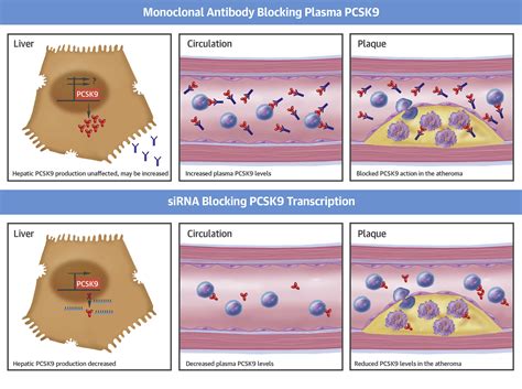 The Evolving Future of PCSK9 Inhibitors | JACC