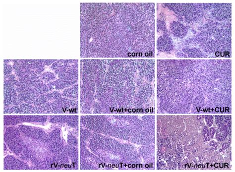 Curcumin Enhances the Antitumoral Effect Induced by the Recombinant ...