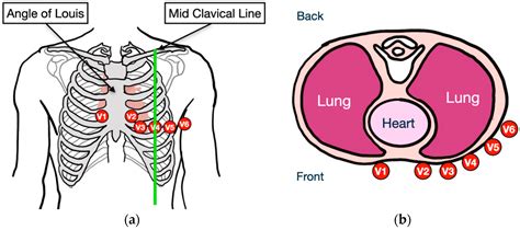 Application of Augmented Reality Technology for Chest ECG Electrode ...